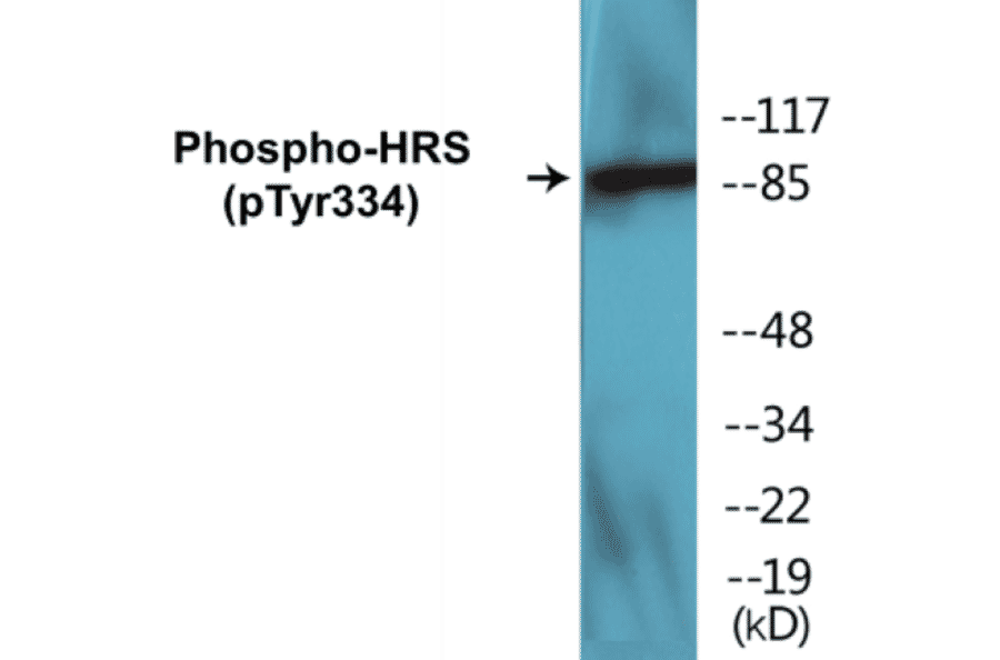 Western Blot - HRS (phospho Tyr334) Cell Based ELISA Kit (CBP1412) - Antibodies.com