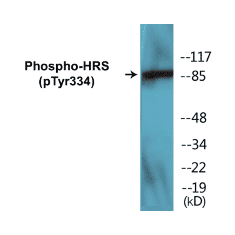 Western Blot - HRS (phospho Tyr334) Cell Based ELISA Kit (CBP1412) - Antibodies.com
