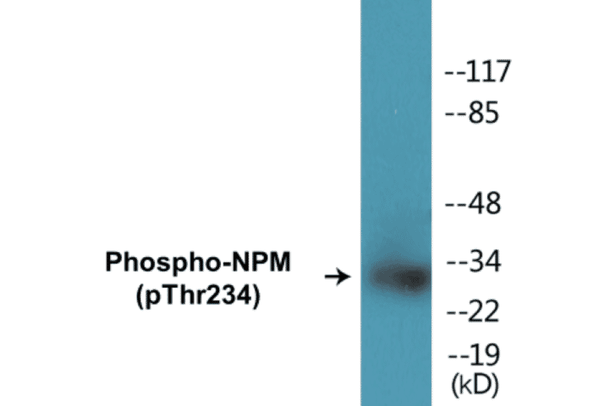 Western Blot - NPM (phospho Thr234) Cell Based ELISA Kit (CBP1455) - Antibodies.com