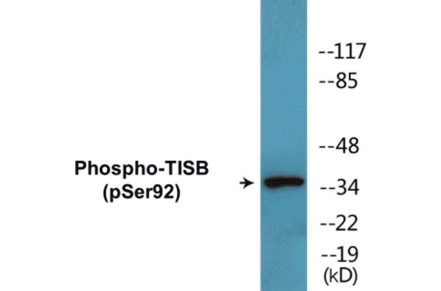 Western Blot - TISB (phospho Ser92) Cell Based ELISA Kit (CBP1461) - Antibodies.com