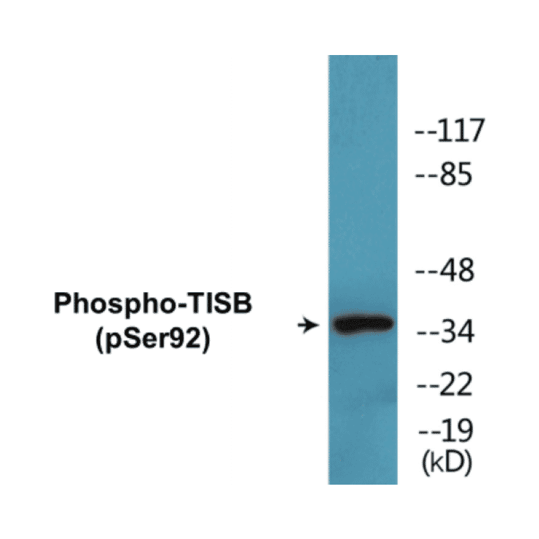 Western Blot - TISB (phospho Ser92) Cell Based ELISA Kit (CBP1461) - Antibodies.com