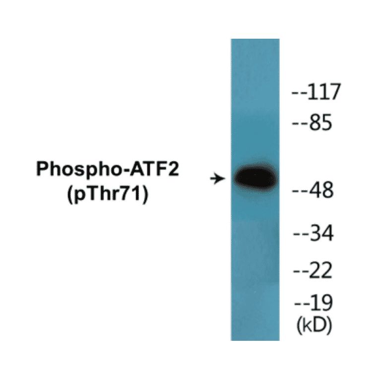 Western Blot - ATF2 (phospho Thr71) Cell Based ELISA Kit (CBP1498) - Antibodies.com