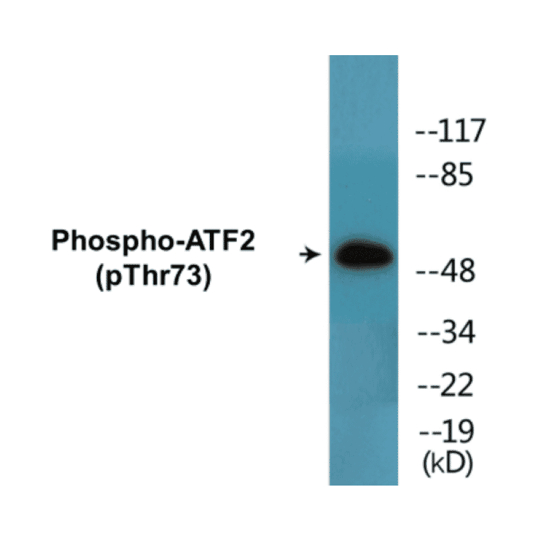 Western Blot - ATF2 (phospho Thr73) Cell Based ELISA Kit (CBP1499) - Antibodies.com