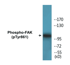 Western Blot - FAK (phospho Tyr861) Cell Based ELISA Kit (CBP1553) - Antibodies.com