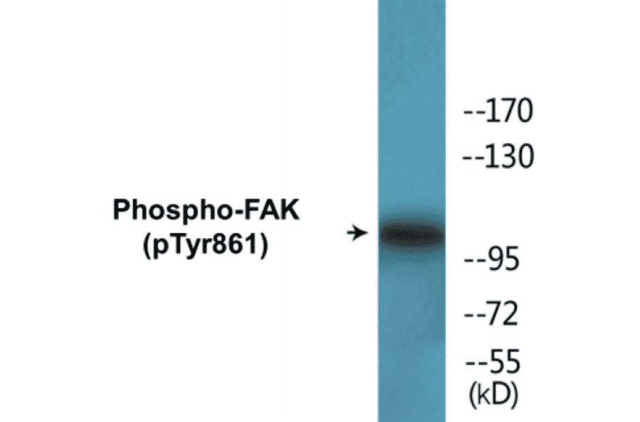 Western Blot - FAK (phospho Tyr861) Cell Based ELISA Kit (CBP1553) - Antibodies.com