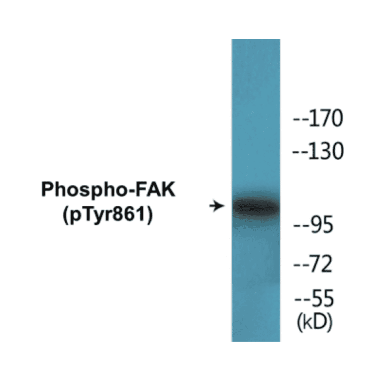 Western Blot - FAK (phospho Tyr861) Cell Based ELISA Kit (CBP1553) - Antibodies.com
