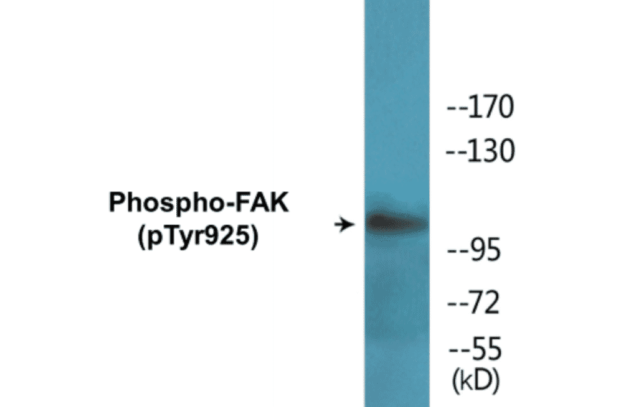 Western Blot - FAK (phospho Tyr925) Cell Based ELISA Kit (CBP1554) - Antibodies.com
