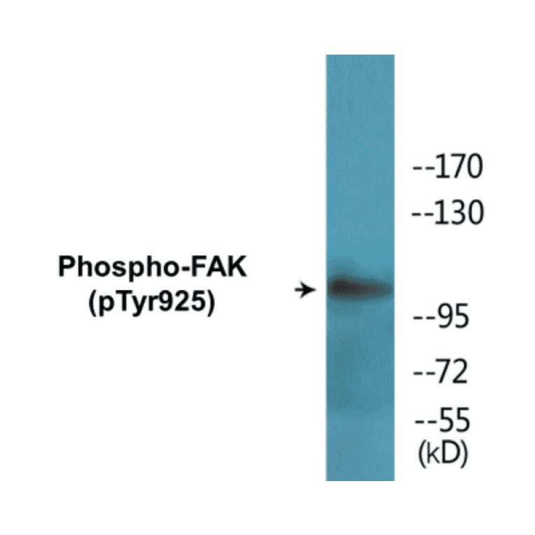 Western Blot - FAK (phospho Tyr925) Cell Based ELISA Kit (CBP1554) - Antibodies.com