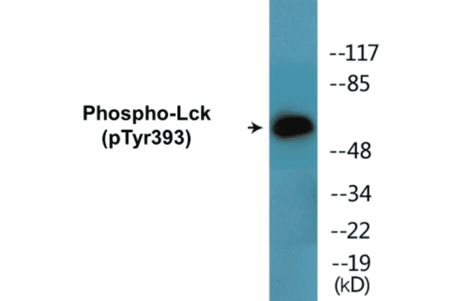 Western Blot - Lck (phospho Tyr393) Cell Based ELISA Kit (CBP1604) - Antibodies.com