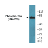 Western Blot - Tau (phospho Ser235) Cell Based ELISA Kit (CBP1694) - Antibodies.com