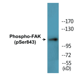 Western Blot - FAK (phospho Ser843) Cell Based ELISA Kit (CBP1721) - Antibodies.com