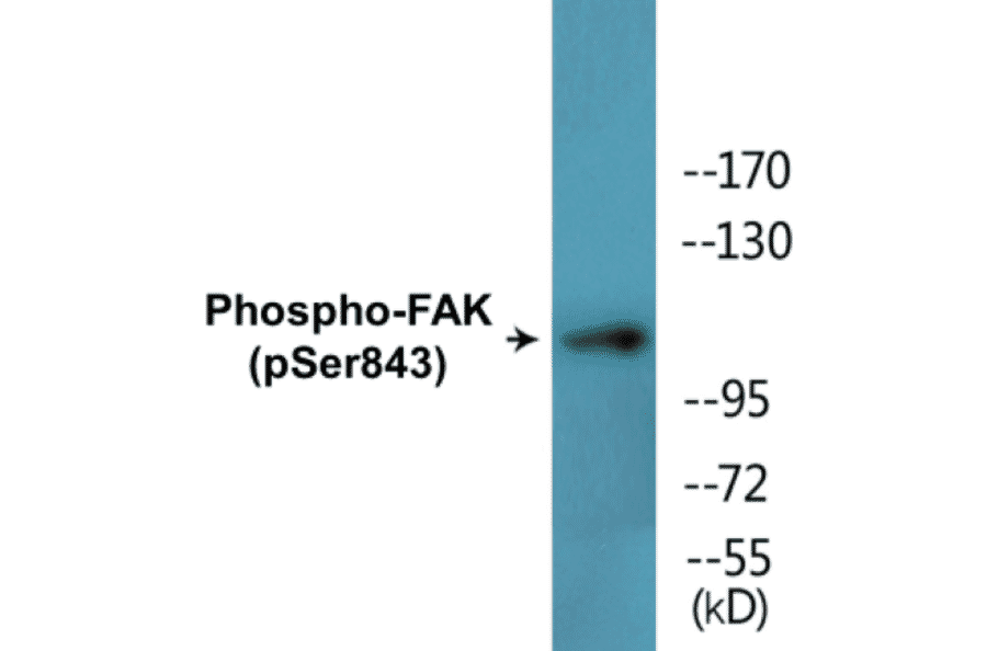 Western Blot - FAK (phospho Ser843) Cell Based ELISA Kit (CBP1721) - Antibodies.com