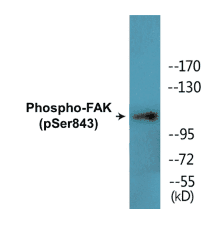 Western Blot - FAK (phospho Ser843) Cell Based ELISA Kit (CBP1721) - Antibodies.com