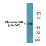 Western Blot - FAK (phospho Ser843) Cell Based ELISA Kit (CBP1721) - Antibodies.com