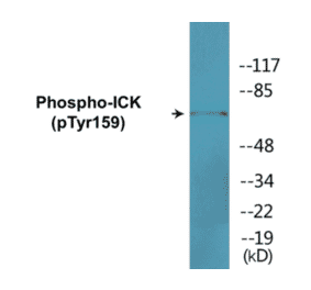 Western Blot - ICK (phospho Tyr159) Cell Based ELISA Kit (CBP1745) - Antibodies.com