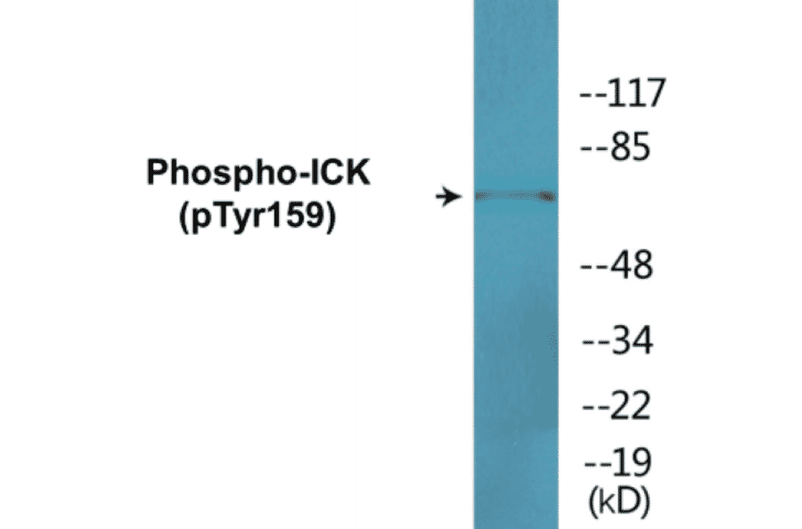 Western Blot - ICK (phospho Tyr159) Cell Based ELISA Kit (CBP1745) - Antibodies.com