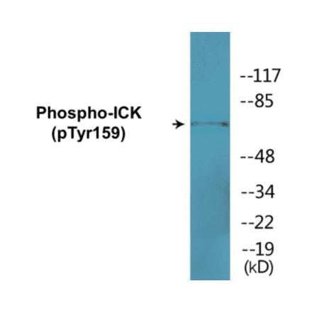 Western Blot - ICK (phospho Tyr159) Cell Based ELISA Kit (CBP1745) - Antibodies.com