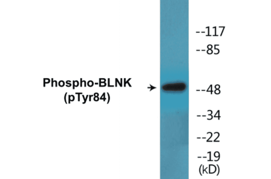 Western Blot - BLNK (phospho Tyr84) Cell Based ELISA Kit (CBP1783) - Antibodies.com