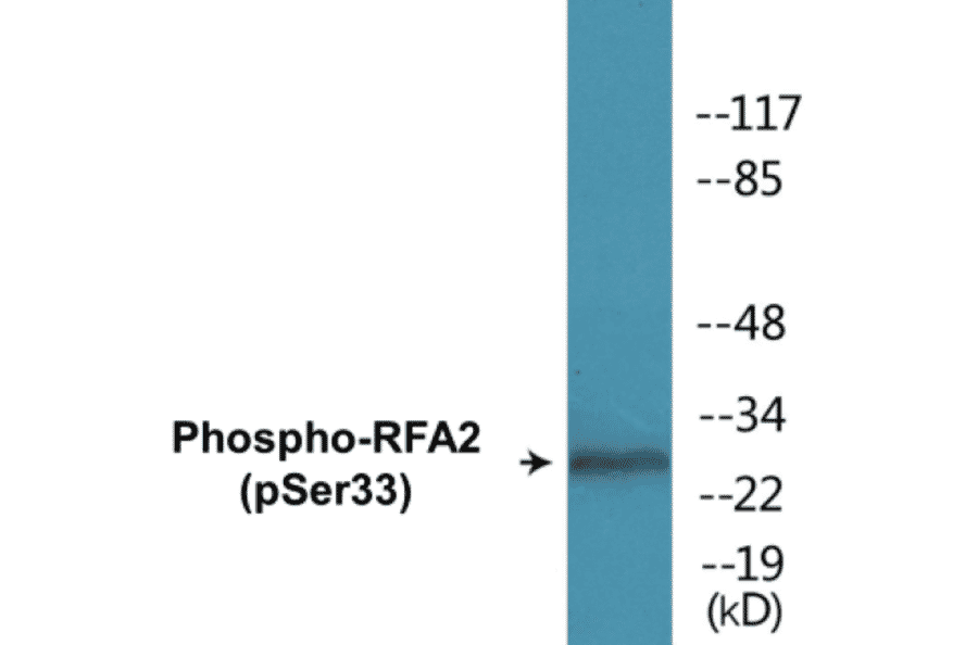 Western Blot - RFA2 (phospho Ser33) Cell Based ELISA Kit (CBP1836) - Antibodies.com
