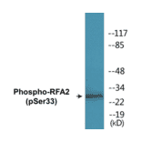 Western Blot - RFA2 (phospho Ser33) Cell Based ELISA Kit (CBP1836) - Antibodies.com