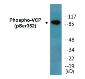 Western Blot - VCP (phospho Ser352) Cell Based ELISA Kit (CBP1846) - Antibodies.com