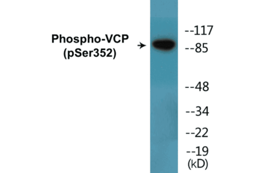 Western Blot - VCP (phospho Ser352) Cell Based ELISA Kit (CBP1846) - Antibodies.com