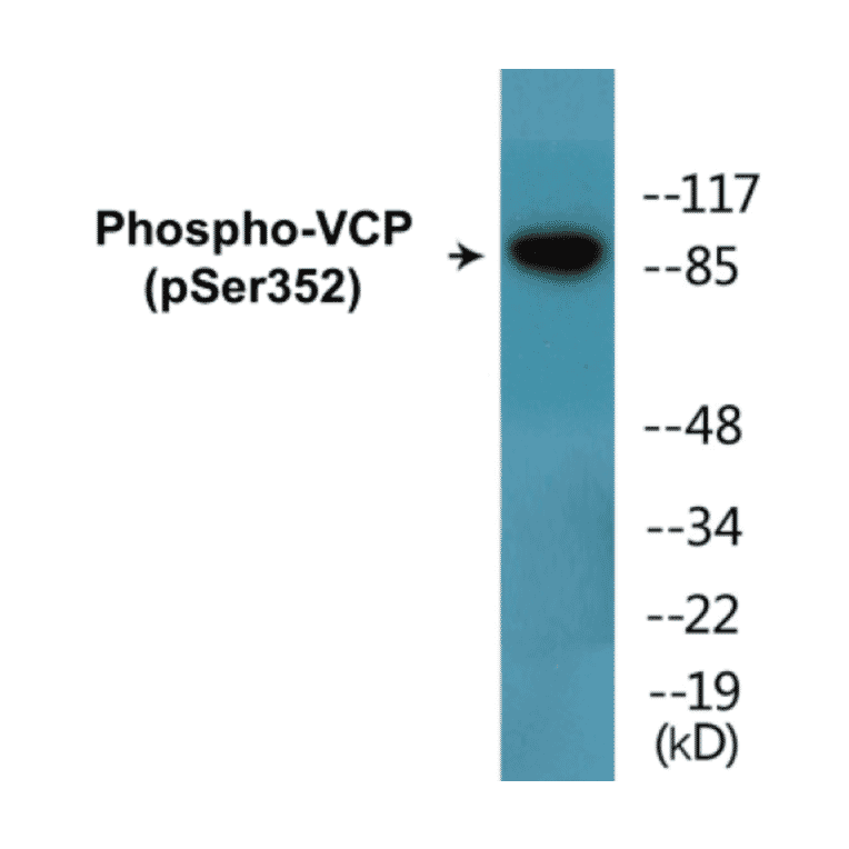 Western Blot - VCP (phospho Ser352) Cell Based ELISA Kit (CBP1846) - Antibodies.com