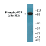 Western Blot - VCP (phospho Ser352) Cell Based ELISA Kit (CBP1846) - Antibodies.com