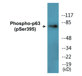 Western Blot - p63 (phospho Ser395) Cell Based ELISA Kit (CBP1851) - Antibodies.com