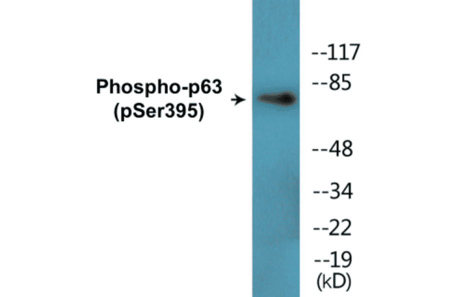 Western Blot - p63 (phospho Ser395) Cell Based ELISA Kit (CBP1851) - Antibodies.com