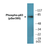 Western Blot - p63 (phospho Ser395) Cell Based ELISA Kit (CBP1851) - Antibodies.com