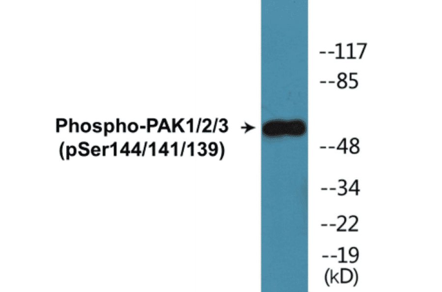 Western Blot - PAK1 + 2 + 3 (phospho Ser144 + Ser141 + Ser139) Cell Based ELISA Kit (CBP1197) - Antibodies.com