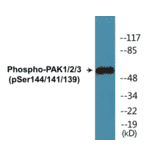 Western Blot - PAK1 + 2 + 3 (phospho Ser144 + Ser141 + Ser139) Cell Based ELISA Kit (CBP1197) - Antibodies.com