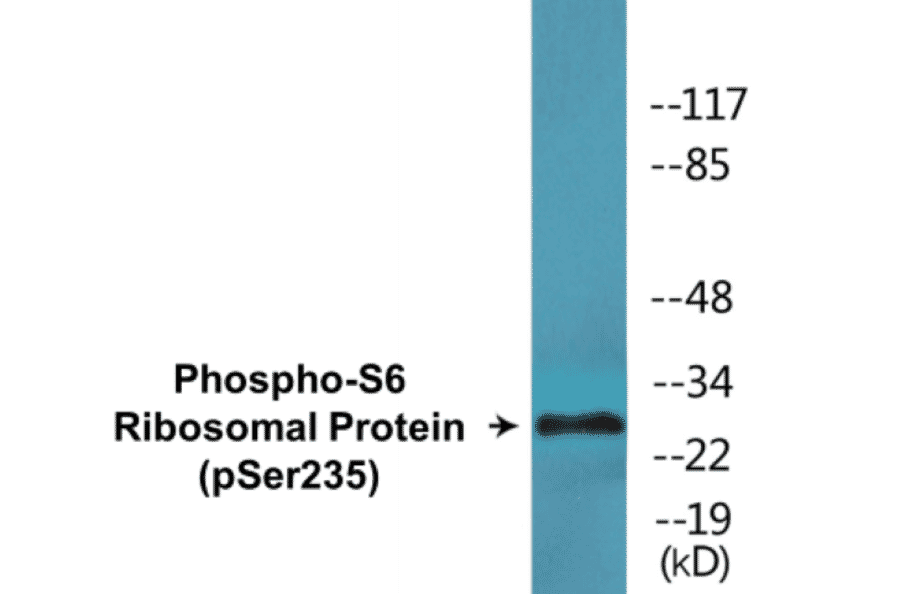 Western Blot - S6 Ribosomal Protein (phospho Ser235) Cell Based ELISA Kit (CBP1671) - Antibodies.com