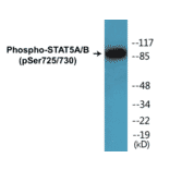 Western Blot - STAT5A + B (phospho Ser725 + Ser730) Cell Based ELISA Kit (CBP1398) - Antibodies.com