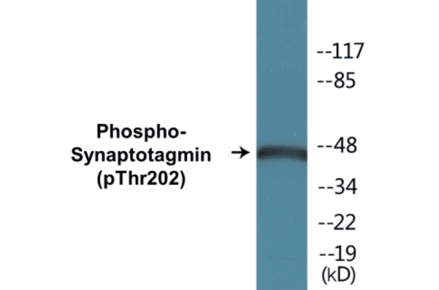 Western Blot - Synaptotagmin (phospho Thr202) Cell Based ELISA Kit (CBP1032) - Antibodies.com