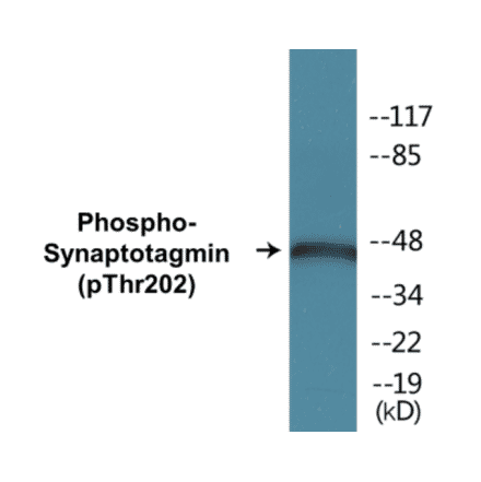 Western Blot - Synaptotagmin (phospho Thr202) Cell Based ELISA Kit (CBP1032) - Antibodies.com