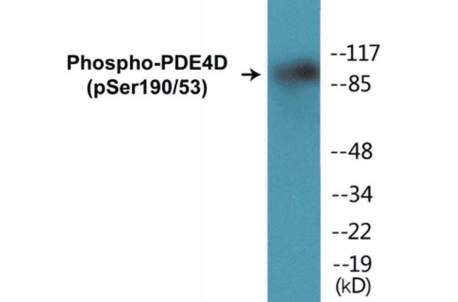 Western Blot - PDE4D (phospho Ser190 + Ser53) Cell Based ELISA Kit (CBP1198) - Antibodies.com