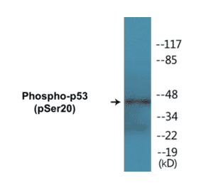 Western Blot - p53 (phospho Ser20) Cell Based ELISA Kit (CBP1187) - Antibodies.com