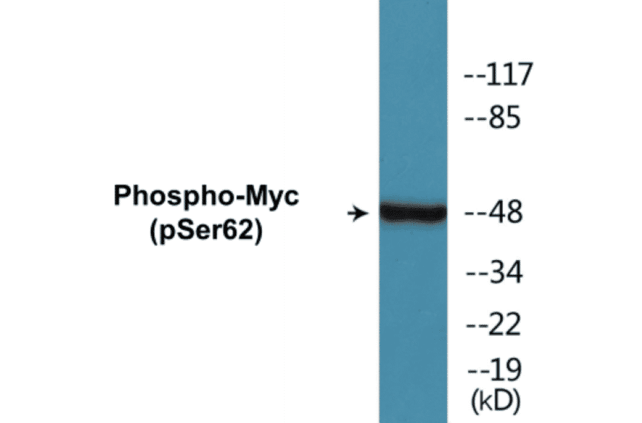 Western Blot - Myc (phospho Ser62) Cell Based ELISA Kit (CBP1020) - Antibodies.com