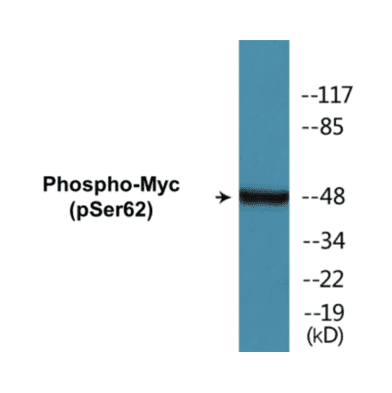 Western Blot - Myc (phospho Ser62) Cell Based ELISA Kit (CBP1020) - Antibodies.com