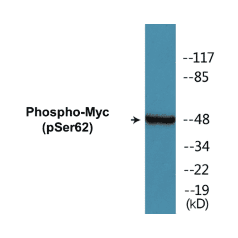 Western Blot - Myc (phospho Ser62) Cell Based ELISA Kit (CBP1020) - Antibodies.com