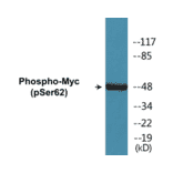 Western Blot - Myc (phospho Ser62) Cell Based ELISA Kit (CBP1020) - Antibodies.com