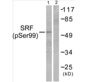 Western Blot - SRF (phospho Ser99) Cell Based ELISA Kit (CBP1081) - Antibodies.com