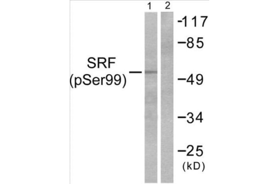 Western Blot - SRF (phospho Ser99) Cell Based ELISA Kit (CBP1081) - Antibodies.com