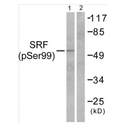 Western Blot - SRF (phospho Ser99) Cell Based ELISA Kit (CBP1081) - Antibodies.com