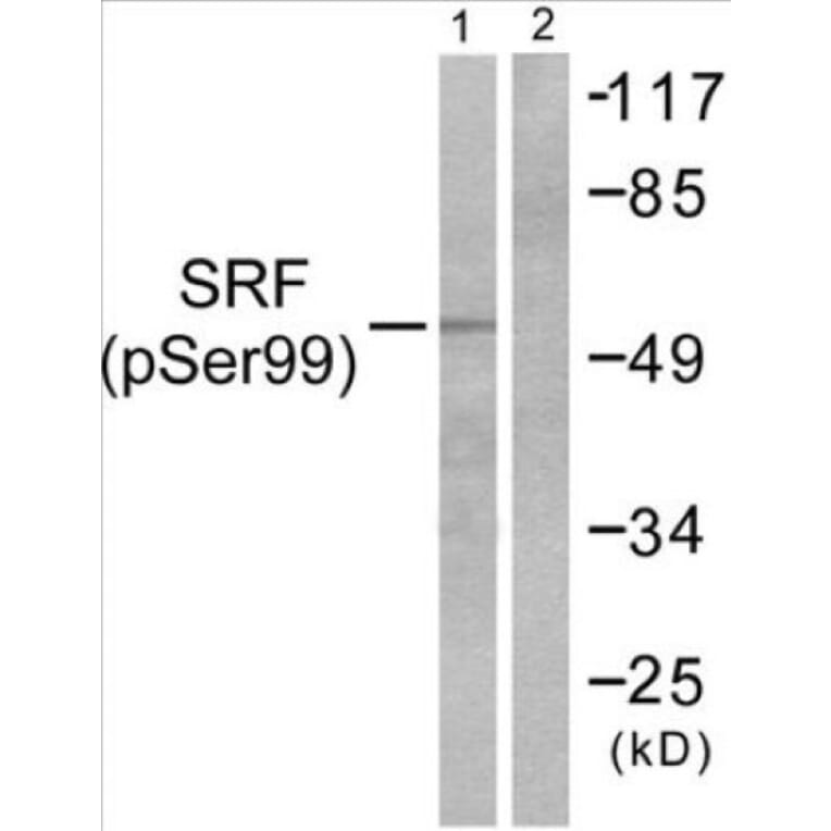 Western Blot - SRF (phospho Ser99) Cell Based ELISA Kit (CBP1081) - Antibodies.com