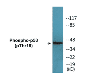 Western Blot - p53 (phospho Thr18) Cell Based ELISA Kit (CBP1649) - Antibodies.com