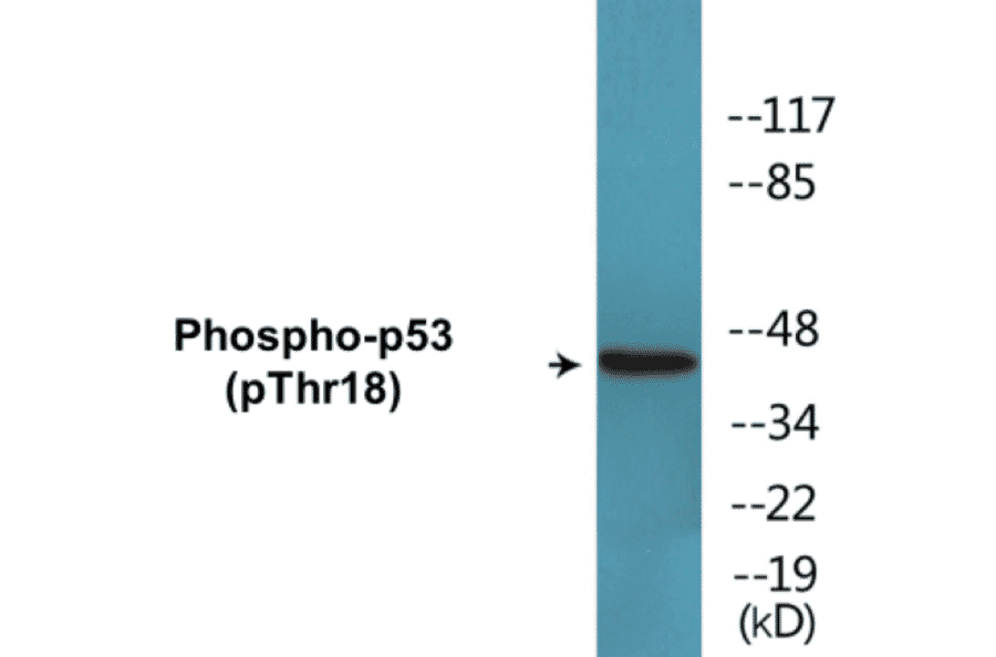 Western Blot - p53 (phospho Thr18) Cell Based ELISA Kit (CBP1649) - Antibodies.com