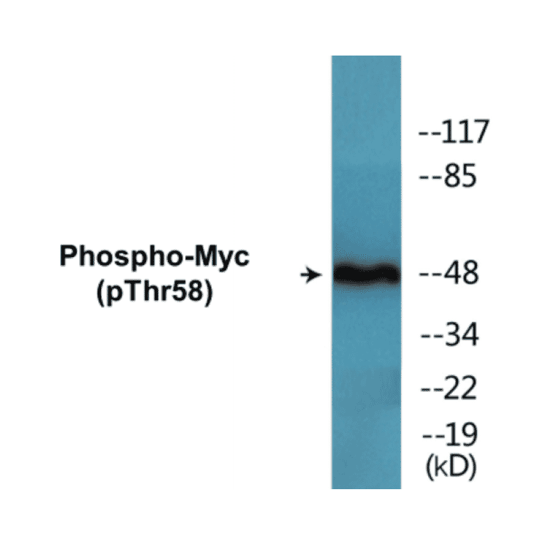 Western Blot - Myc (phospho Thr58) Cell Based ELISA Kit (CBP1621) - Antibodies.com